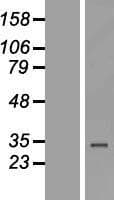 ZNF302 Protein (Over-Expression Lysate Myc-DDK (Flag))