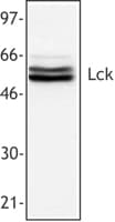 IHC-plus™ Monoclonal Mouse anti-Human p56lck / LCK Antibody (clone Lck-01, IHC, WB)