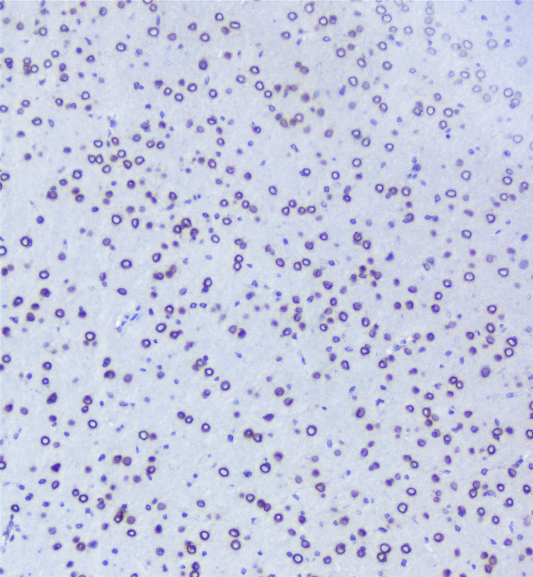 TPR Antibody