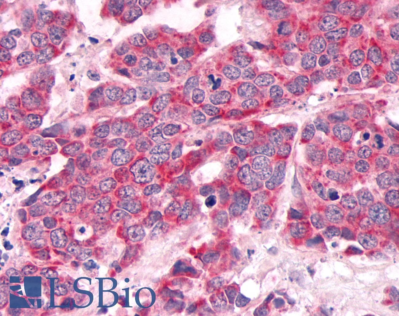 PathPlus™ DUSP26 / MKP8 Antibody (C-Terminus)