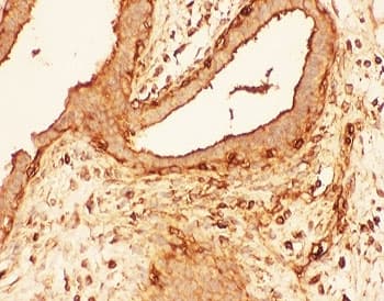 CFL1 / Cofilin Antibody (aa2-166)