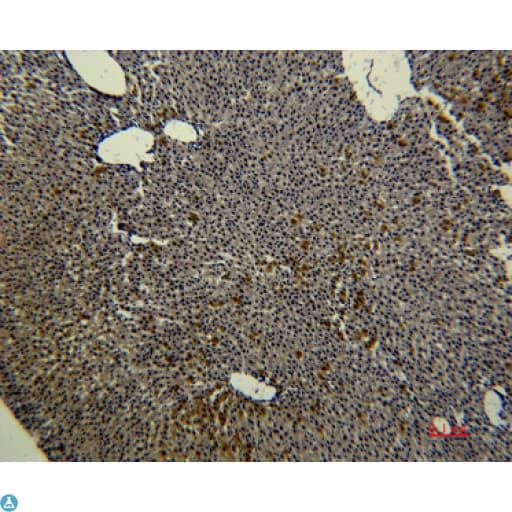 TF / Transferrin Antibody