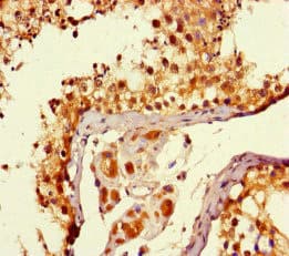 Polyclonal Rabbit anti-Human MTOR Antibody (IHC, IF)