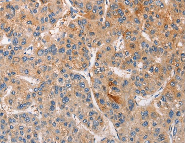 Polyclonal Rabbit anti-Human CCL4 / MIP-1 Beta Antibody (IHC)