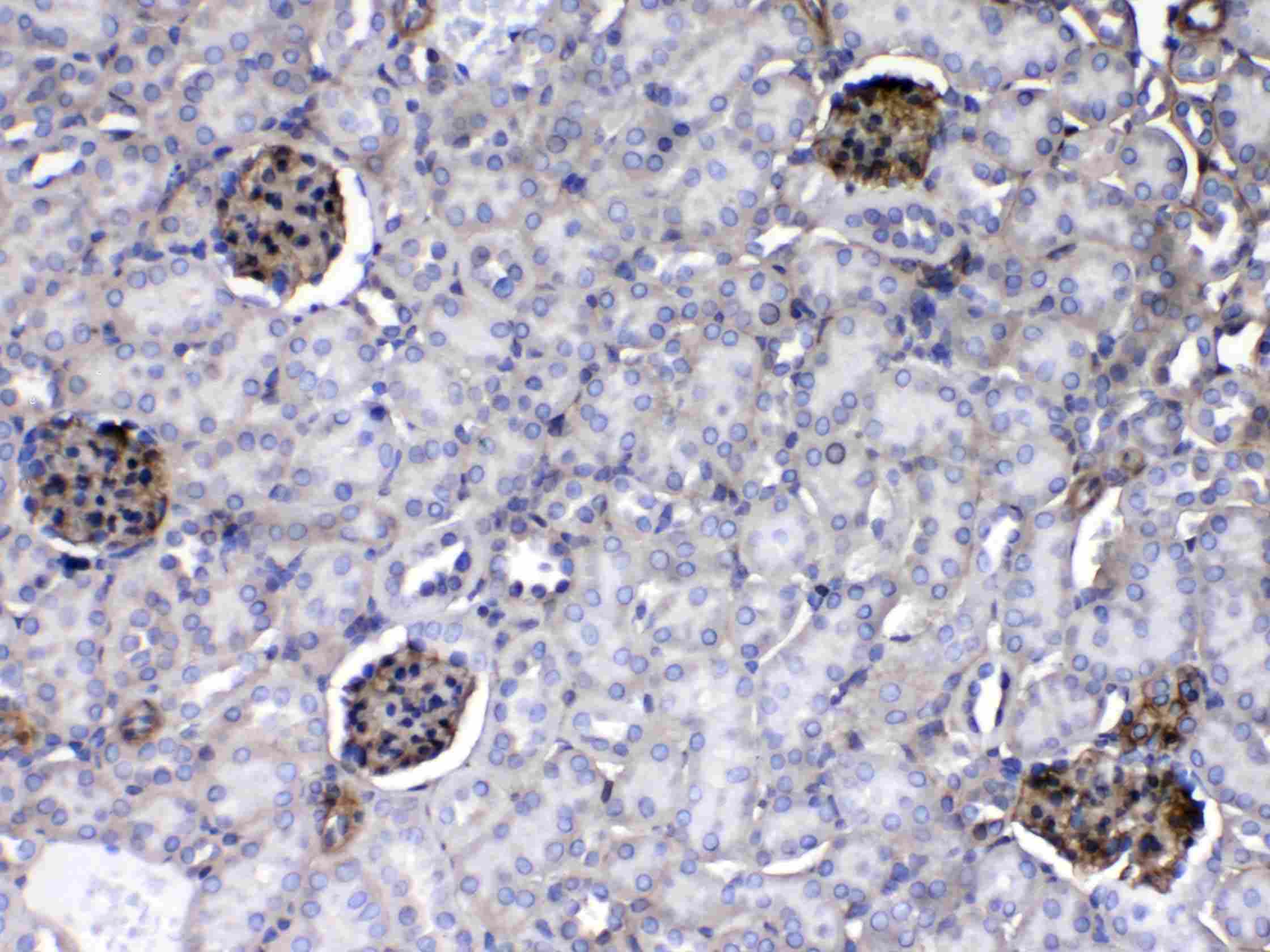 LAMC1 / Laminin Gamma 1 Antibody