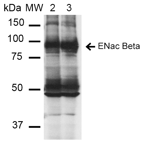 SCNN1B / ENaC Beta Antibody (clone 16E4, FITC)
