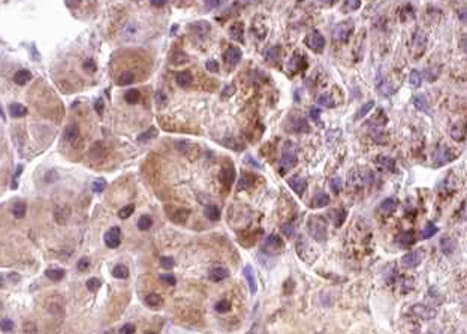 EIF4EBP1 / 4EBP1 Antibody (phospho-Thr36)