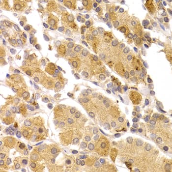 Polyclonal Rabbit anti-Human ART5 Antibody (IHC, WB)