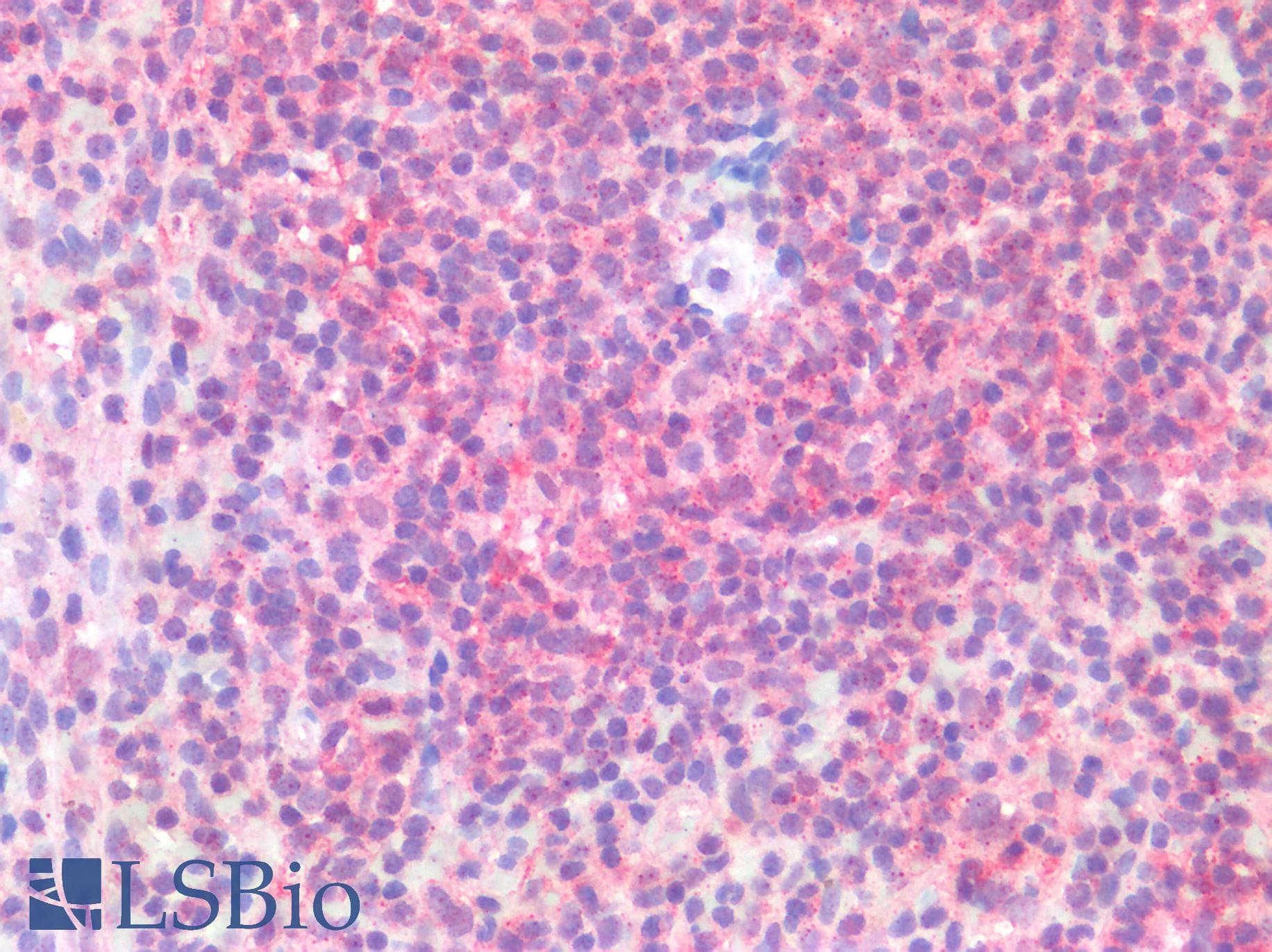 IHC-plus™ Polyclonal Rabbit anti-Human SIAH2 Antibody (IHC)