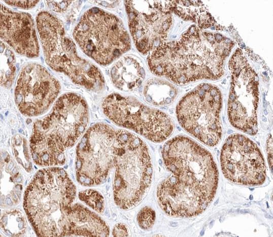 Polyclonal Rabbit anti-Human PTCH1 / Patched 1 Antibody (IHC, IF, WB)