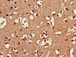 SRR / Serine Racemase Antibody