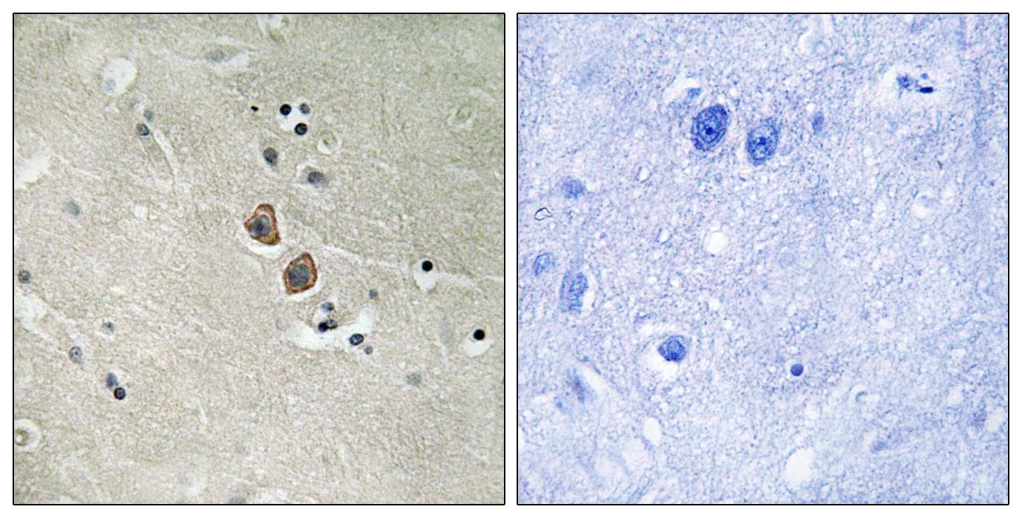 NPTN / SDR1 Antibody