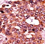 CDC6 Antibody (phospho-Ser54)