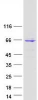 Human C1orf87 Protein (Recombinant Myc-DDK (Flag))