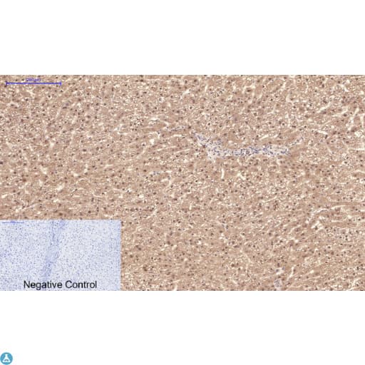 PPARD / PPAR Delta Antibody