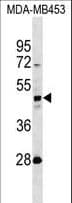 KRT31 / Keratin 31 / KRTHA1 Antibody (aa60-89)