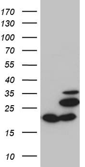 Monoclonal Mouse anti-Human MRPL48 Antibody (clone OTI3C5, IHC, WB)