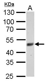Polyclonal Rabbit anti-Human FBXL3 Antibody (aa14-309, WB)