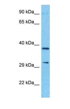 Polyclonal Rabbit anti-Human NDUFA10 Antibody (N-Terminus, WB)
