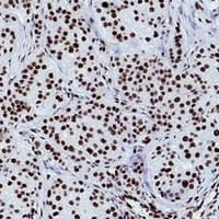 HIST1H3H Antibody