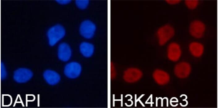 Histone H3 Antibody (Tri-Methyl-Lys4)