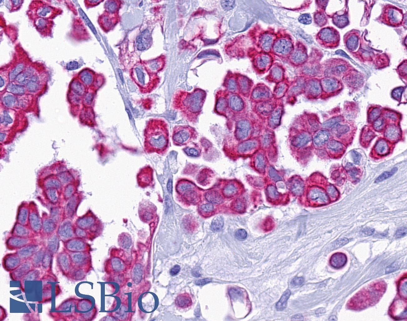 PathPlus™ P2RY14 / GPR105 Antibody (C-Terminus)