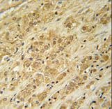 DKC1 / Dyskerin Antibody (aa185-213)