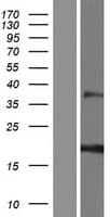 Human RNF224 Protein (Over-Expression Lysate Myc-DDK (Flag))
