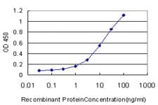 CDKN2AIP Antibody (clone 1A6)
