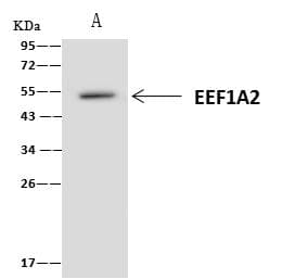 EEF1A2 Antibody