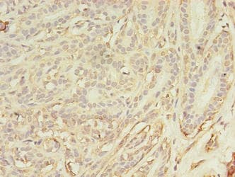 Polyclonal Rabbit anti-Human ASB11 Antibody (IHC)