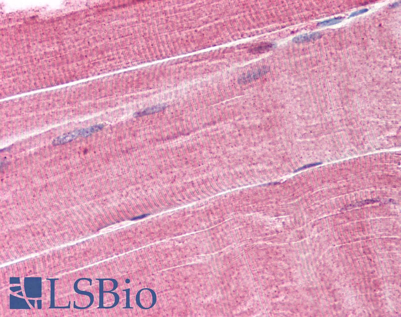 IHC-plus™ Polyclonal Goat anti-Human MURF1 / IRF Antibody (aa2-14, IHC)