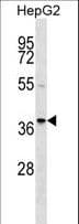Polyclonal Rabbit anti-Human RALY Antibody (aa75-103, WB)