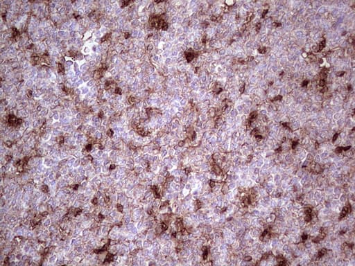 LGALS3 / Galectin 3 Antibody (clone UMAB189)