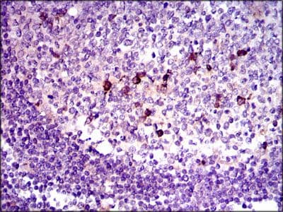 TGFB1 / TGF Beta 1 Antibody (Amino Acid: 62-195, clone 7F6)