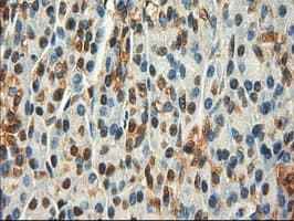 MYC / c-Myc Antibody (clone OTI3F2)
