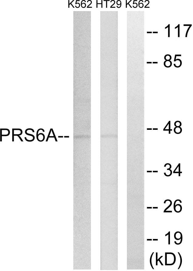 Polyclonal Rabbit anti-Human PSMC3 Antibody (WB)