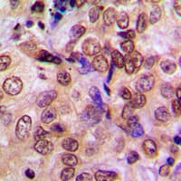 MTA1 Antibody (Internal)