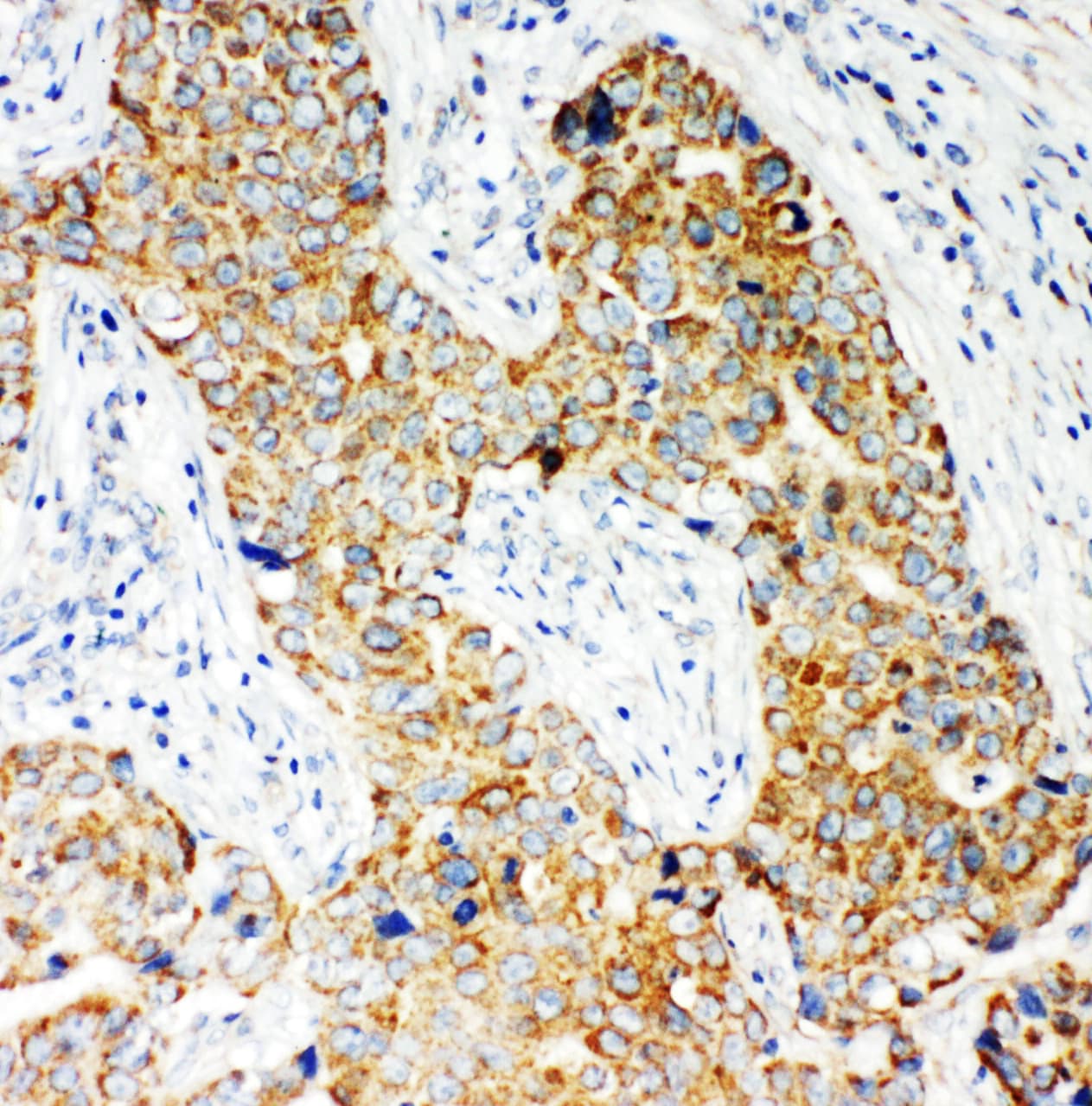 Polyclonal Rabbit anti-Human NOX5 Antibody (aa747-765, IHC, WB)