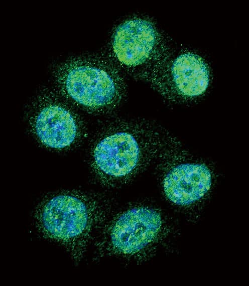 ALOX15 / 15-Lipoxygenase Antibody (aa610-643)
