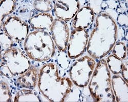 LIPG / Endothelial Lipase Antibody (clone OTI9C5)