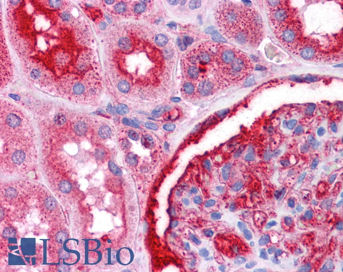 Polyclonal Rabbit anti-Human NR4A2 / NURR1 Antibody (N-Terminus, IHC, WB)