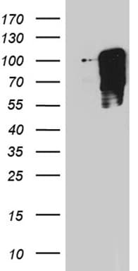 TBX3 Antibody (aa244-481, clone OTI3B1)