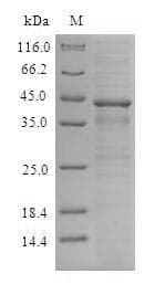Human CXCR4 Protein (Recombinant 6His, N-terminus)