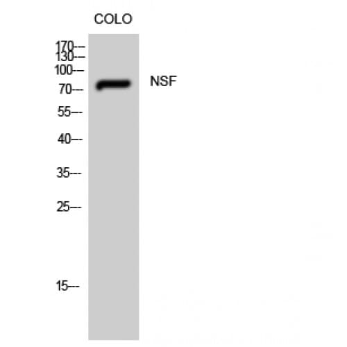 NSF Antibody (110-190 aa, Internal)