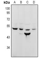 NUSAP1 / NUSAP Antibody
