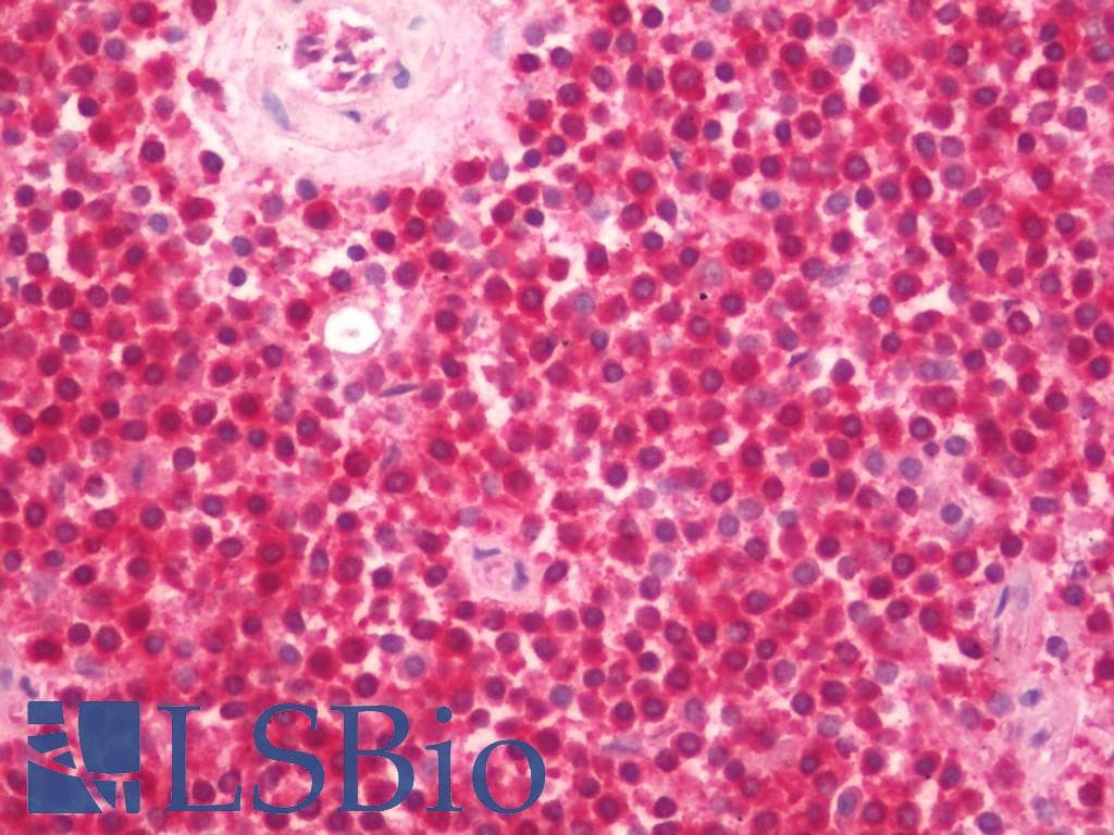 IHC-plus™ NMI Antibody (clone 9D8)