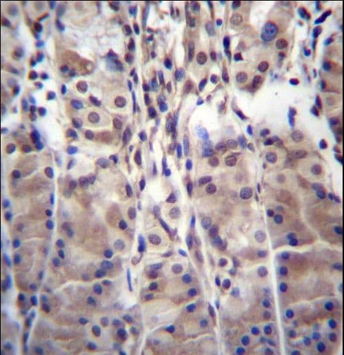 MDM1 Antibody (aa656-684)
