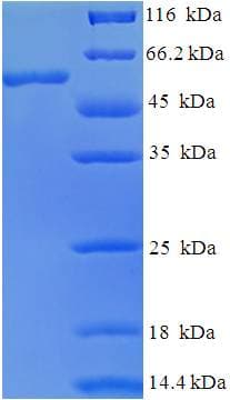 Human GB5 / GNB5 Protein (Recombinant His-SUMO)