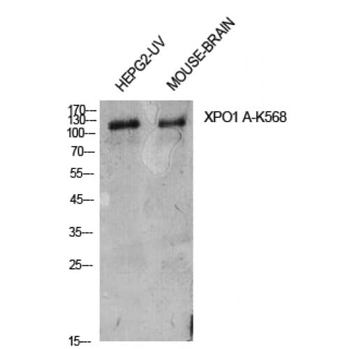 Polyclonal Rabbit anti-Human XPO1 / CRM1 Antibody (Internal, WB)
